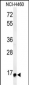 RPS13 Antibody (Center)